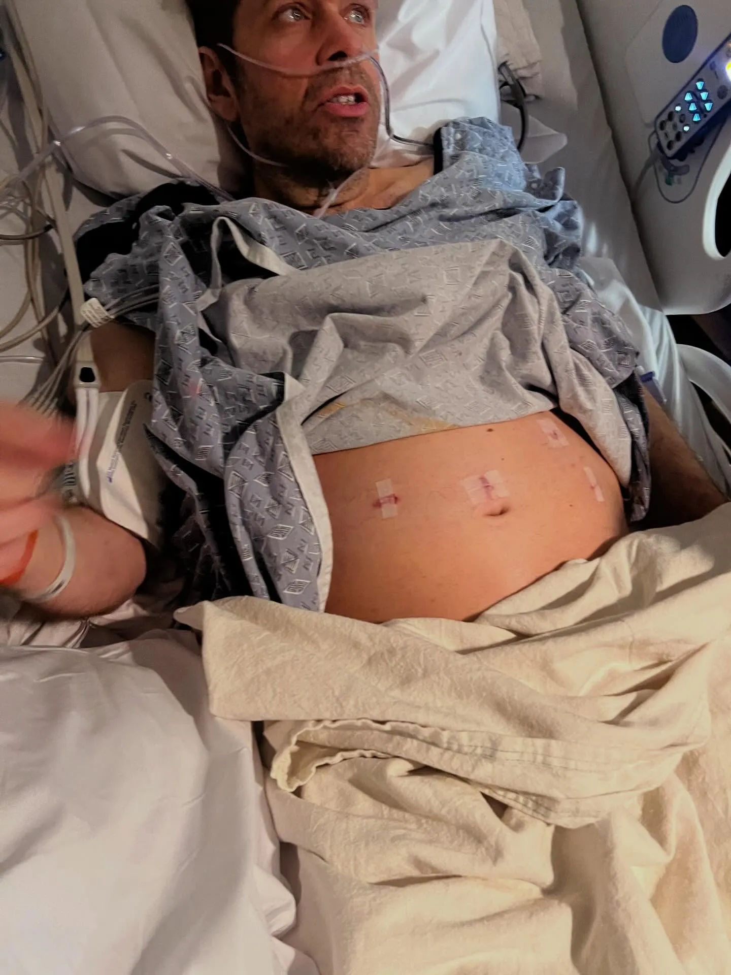 Perez Hilton in a hospital bed with a nasal cannula, bandages on his abdomen, and medical equipment beside him.